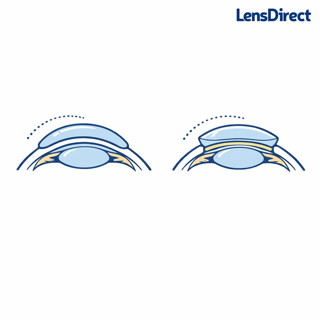 Side-by-side line art of a soft lens draping over an eye curve versus an RGP lens holding its shape.